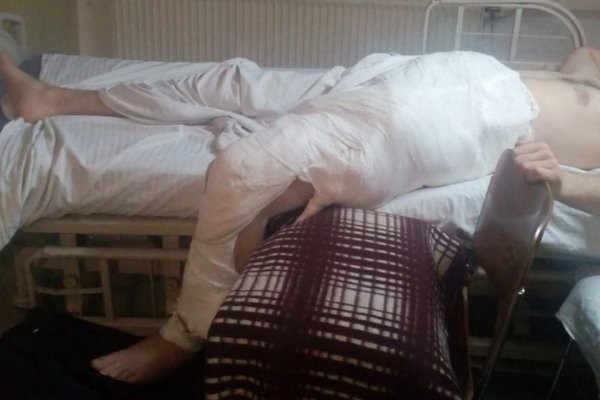 Барнаульский студент перенес пять операций после того, как ему прострелил ногу пьяный фермер