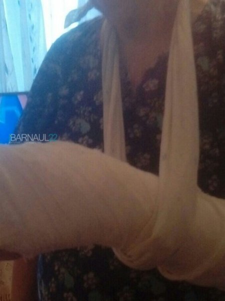 Пенсионерка из Барнаула сломала руку, выпав из автобуса
