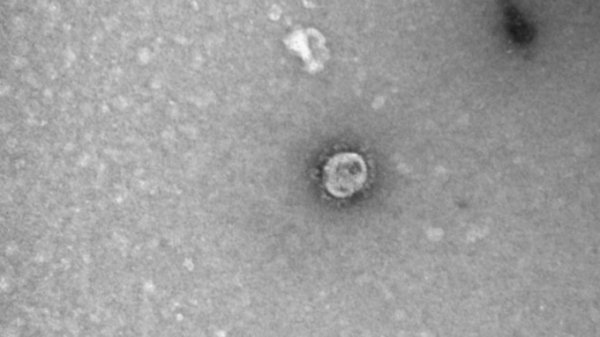 Сибирские ученые показали, как выглядит коронавирус