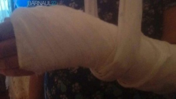 86-летняя жительница Барнаула выпала из автобуса и сломала руку