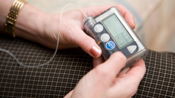 Терапия нового поколения: что такое инсулиновые помпы и в чем их преимущества